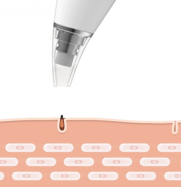 Аппарат для косметологии InFace Black Head Gauge MS7000, розовый фото 2